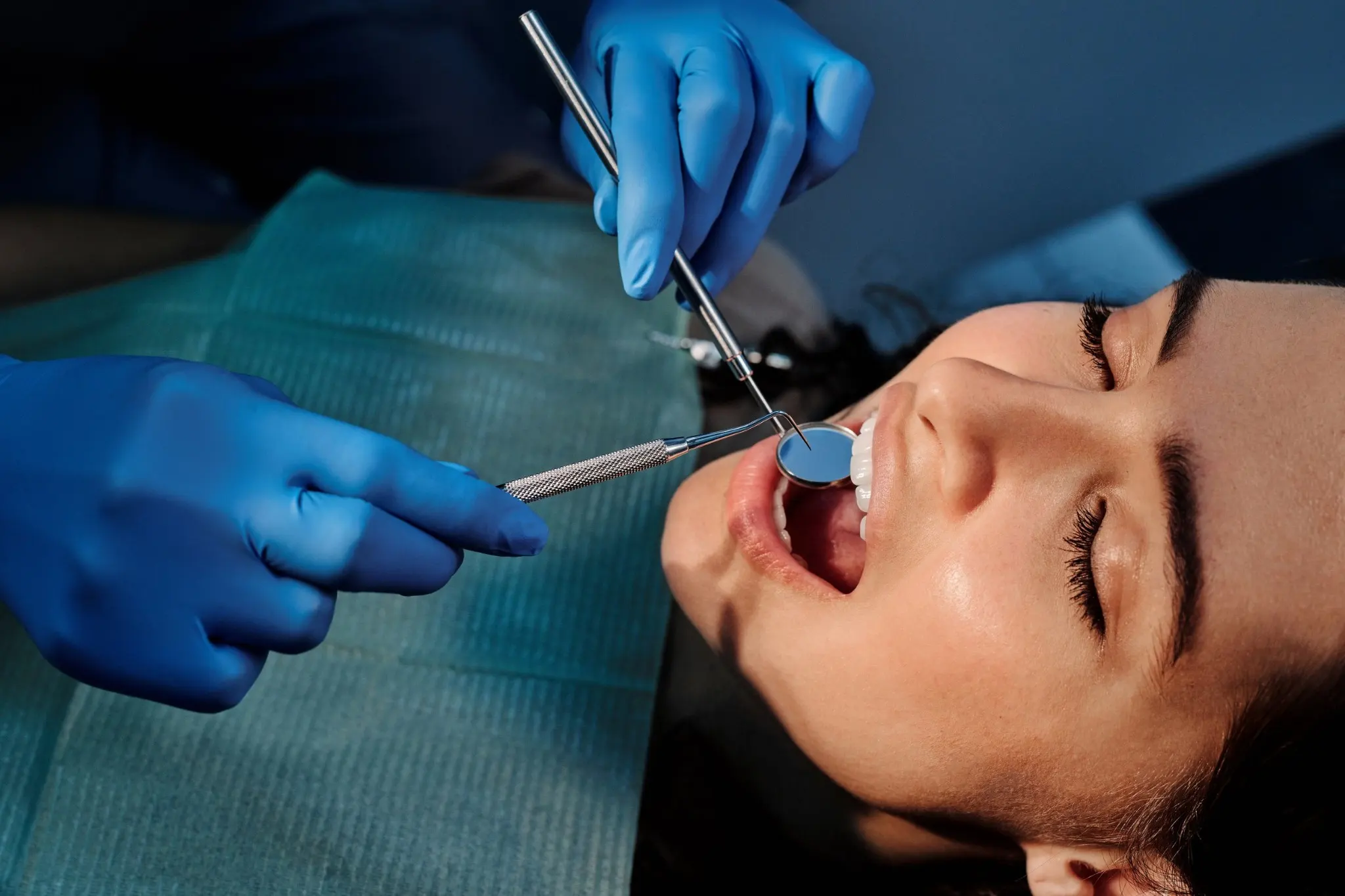 Implantes dentales: cuándo son necesarios y qué ventajas tienen