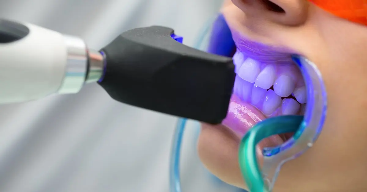 Estética dental en Usera