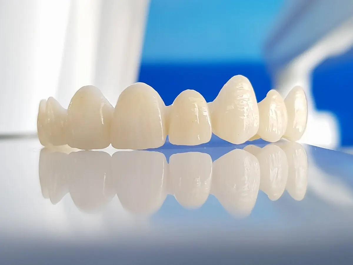 Fundas de porcelana y Zirconio en Usera